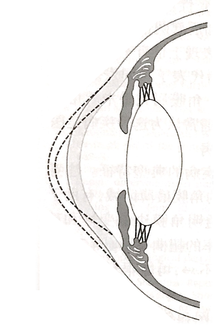 04b6737e3d1ffa9dcd690d07b50c9965.png 04b6737e3d1ffa9dcd690d07b50c9965.png