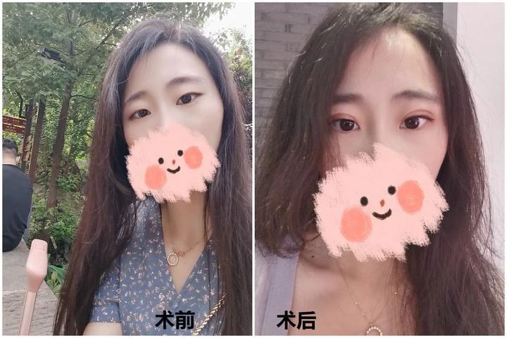 05a0e699345cf07ecbb1c62b5e4503e2.jpg 05a0e699345cf07ecbb1c62b5e4503e2.jpg