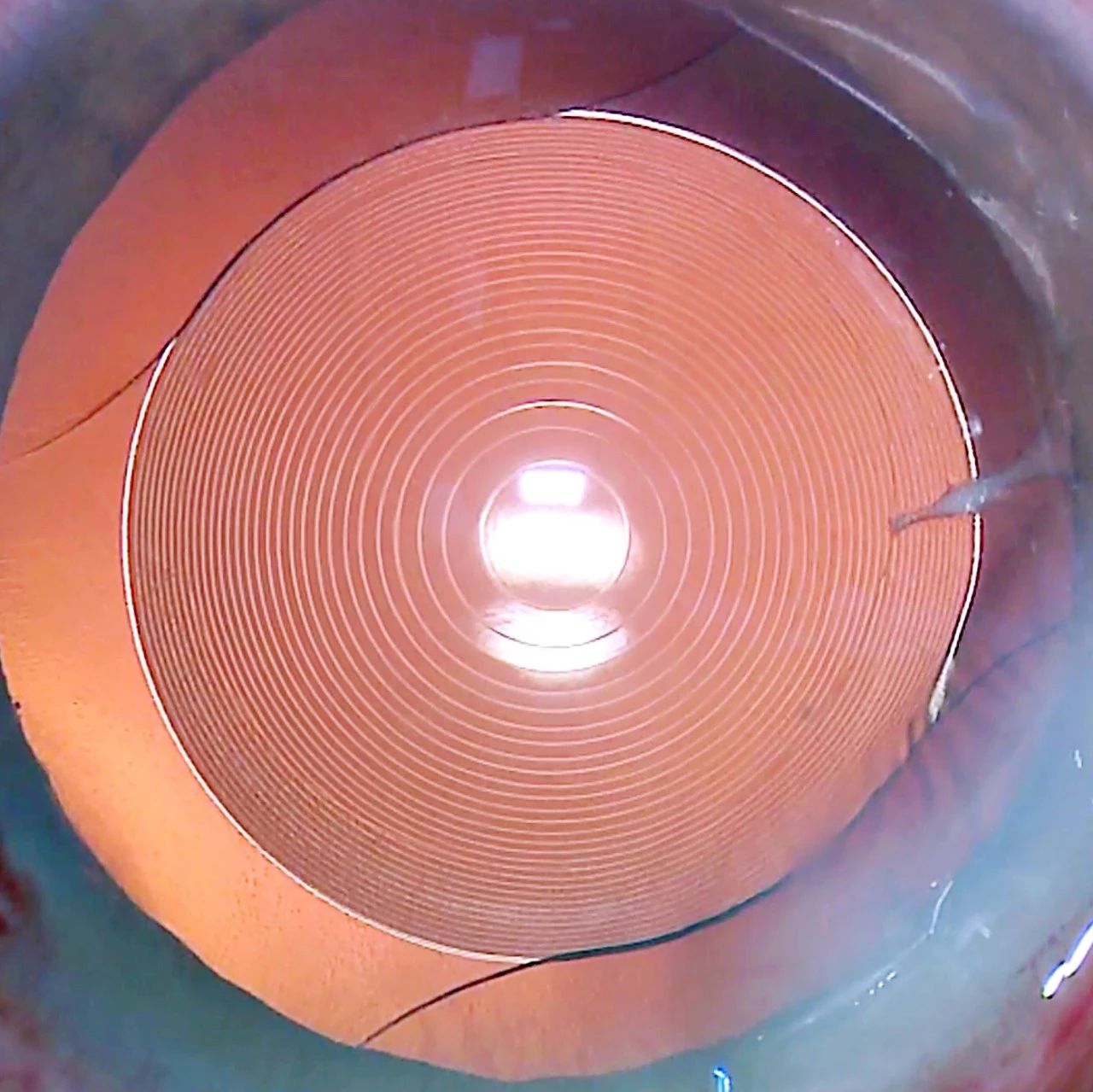 aea36d90f30b069b9dab7d78fe8baf9c.jpg aea36d90f30b069b9dab7d78fe8baf9c.jpg