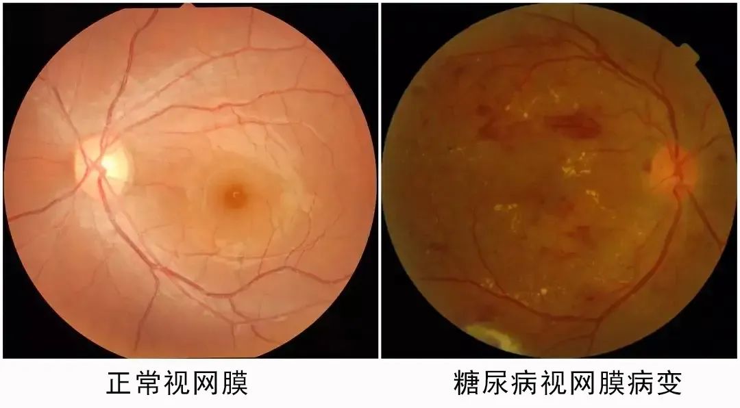 31fd607f68bbba92a60901e4cad8b6cc.jpg 31fd607f68bbba92a60901e4cad8b6cc.jpg