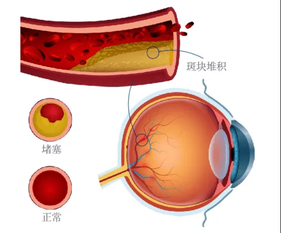 699def121a8ac2d6cafcfce6ea651ad5.png 699def121a8ac2d6cafcfce6ea651ad5.png